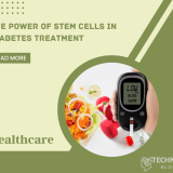 The Power of Stem Cells in Diabetes Treatment