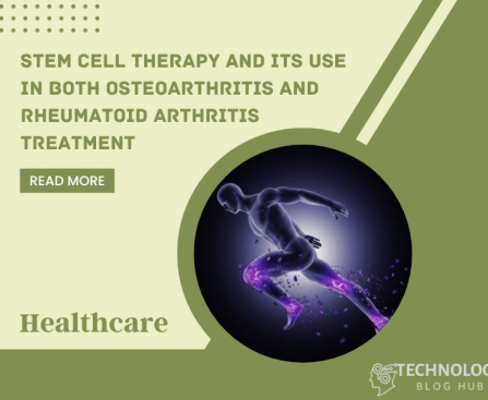 Stem Cell Therapy and its use in both Osteoarthritis and Rheumatoid Arthritis Treatment