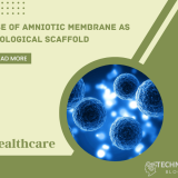 Use of Amniotic Membrane as Biological Scaffold