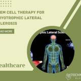 Stem Cell Therapy for Amyotrophic Lateral Sclerosis