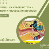 Vestibular Hypofunction - Sensory Processing Disorder