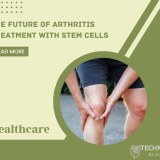 The Future of Arthritis Treatment with Stem Cells
