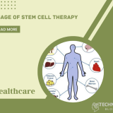 Usage of Stem Cell Therapy